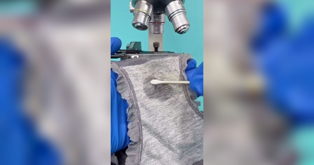 3 Hari Tak Pernah Dicuci, Begini Penampakan Celana Dalam Wanita Dilihat Pakai Mikroskop