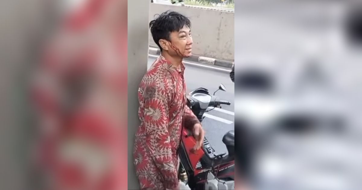 Miris Pengendara Motor Kecelakaan, Handphone dan Dompet Malah Dicuri Orang yang Bantu