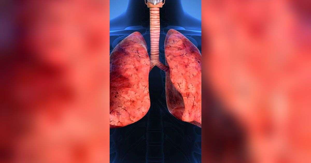 Perbedaan Paru-paru Perokok dan Bukan Perokok, Ketahui Ciri-cirinya