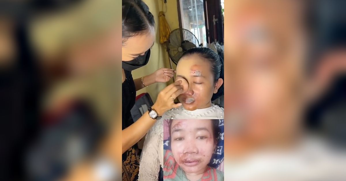 Wajah Pengantin Hancur Akibat Kecelakaan, Riasan MUA jadi 'Penyelamat' di Hari Pernikahan, Hasilnya Bikin Takjub!