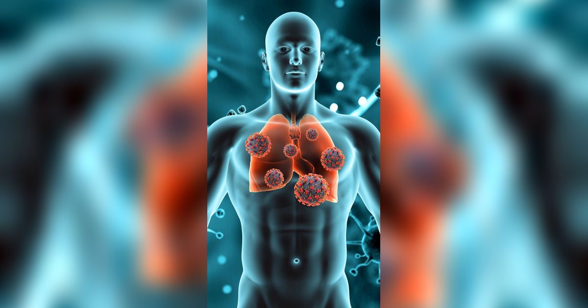 Gejala TBC Paru, Penyebab, Penularan, dan Cara Pencegahannya