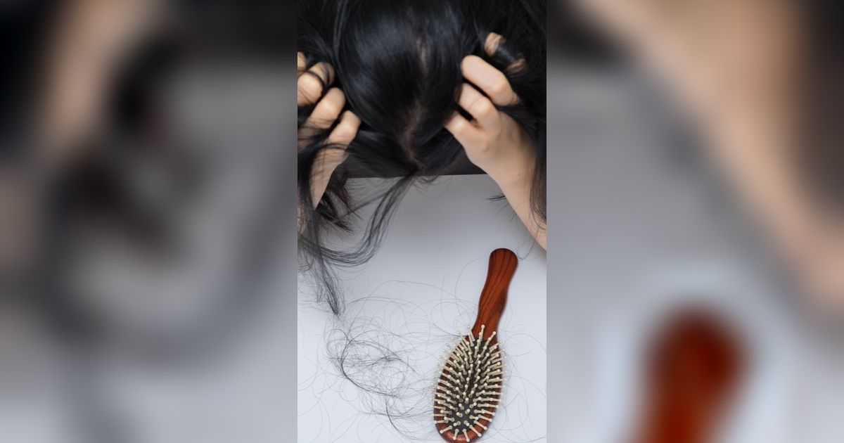 Rambut Rontok Ternyata Tak Cukup Diatasi Pakai Sampo Saja, Solusinya?