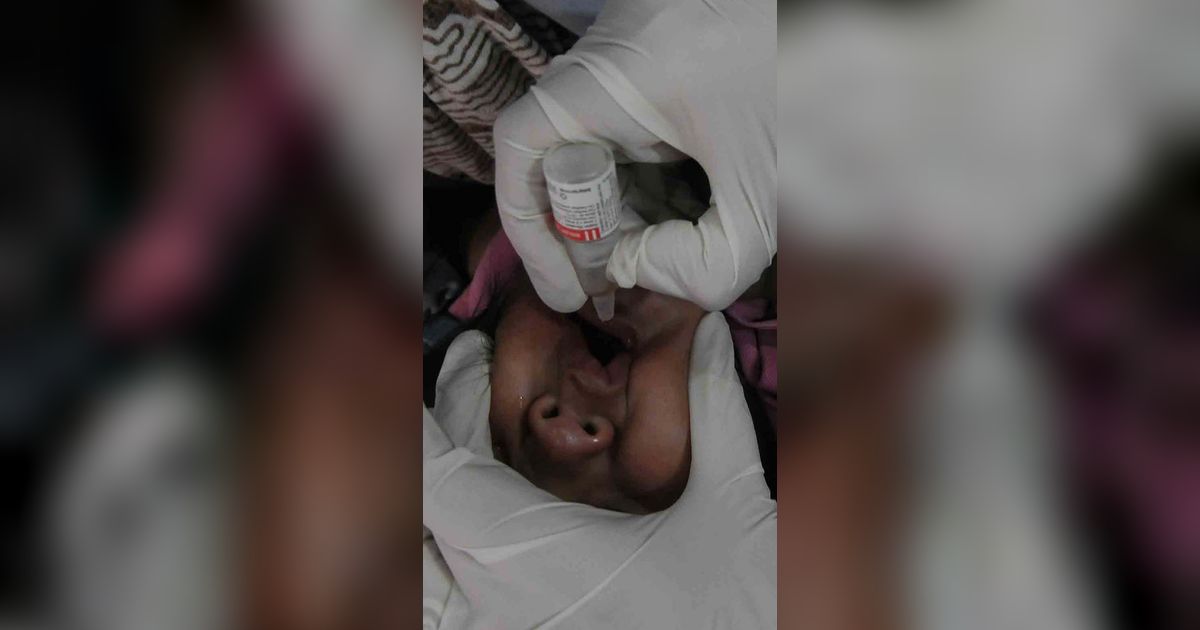 FOTO: Cegah Diare Berat, Kemenkes Gelar Imunisasi Rotavirus Secara Nasional