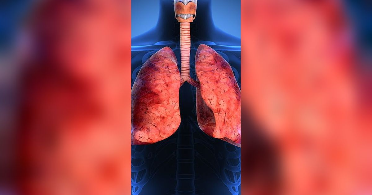 Dampak Polusi Udara terhadap Paru-Paru, Bisa Sebabkan Kanker Paru