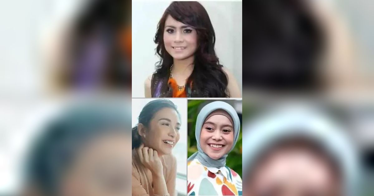 6 Artis Ini Putuskan Hilangkan Gigi Gingsul, Ini Potret Sebelum dan Sesudahnya