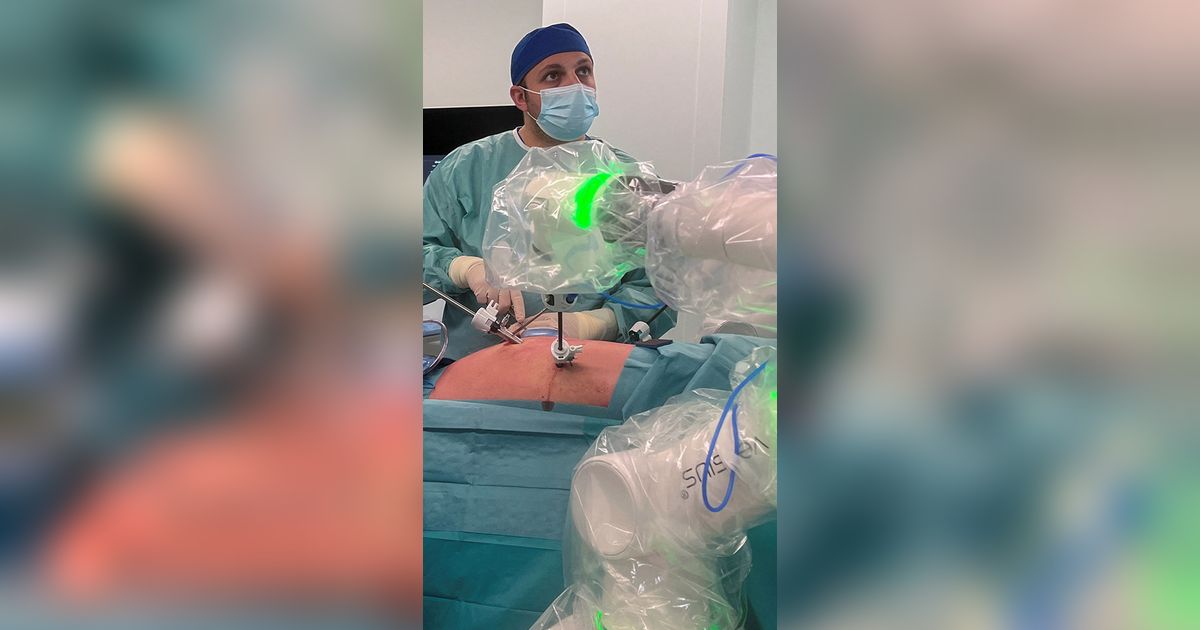 FOTO: Canggih! Dokter di Yordania Gunakan Robot untuk Operasi Pasien Kanker, Diklaim Lebih Akurat dan Kurangi Rasa Sakit