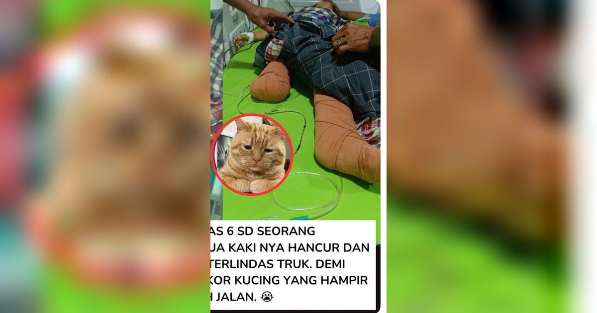 Kisah Viral Bocah Nabila Febrianti, Kaki Diamputasi Gara-Gara Selamatkan Kucing dari Kecelakaan