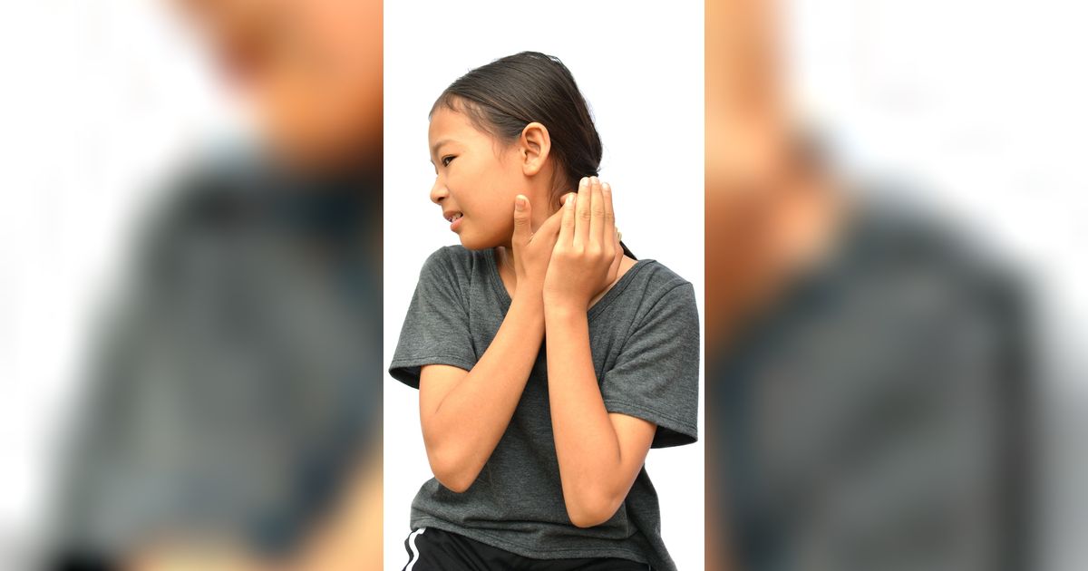 Bercak Putih di Wajah Anak Tak Selalu Panu, Bisa Karena Eksim