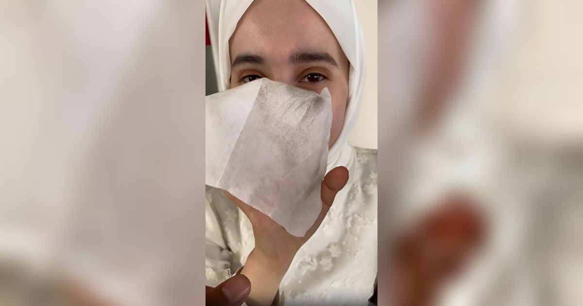 Polusi Udara Tak hanya di Jakarta! Pria Ini Kaget Lihat Tisu Bekas Mengelap Wajah Istri Berubah Hitam Usai Motoran di Bali