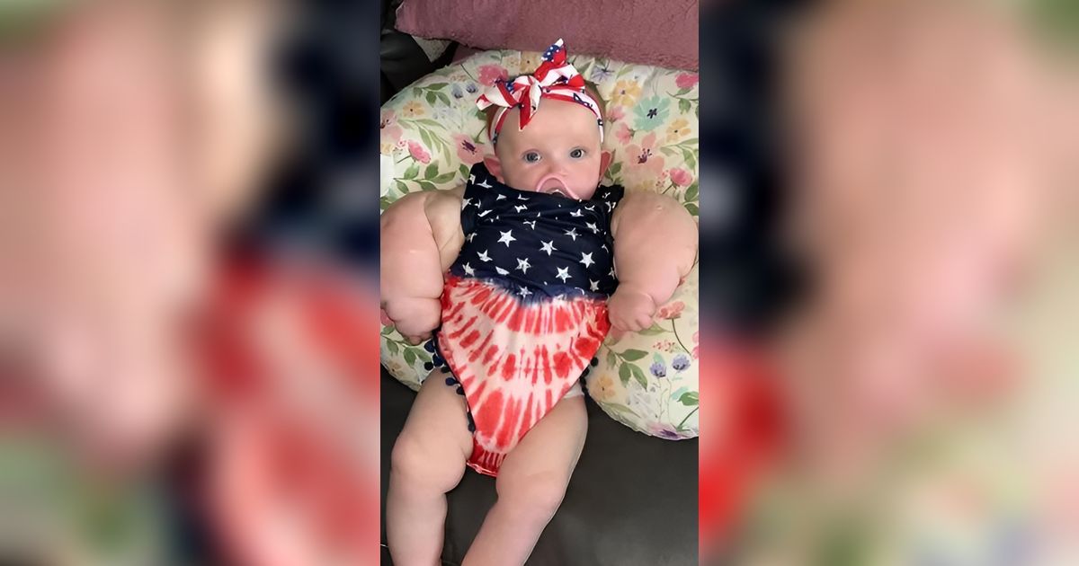 Viral! Foto-Foto Bayi Lahir Prematur dengan Dada dan Lengan Besar, Dijuluki 'Bayi Hulk'