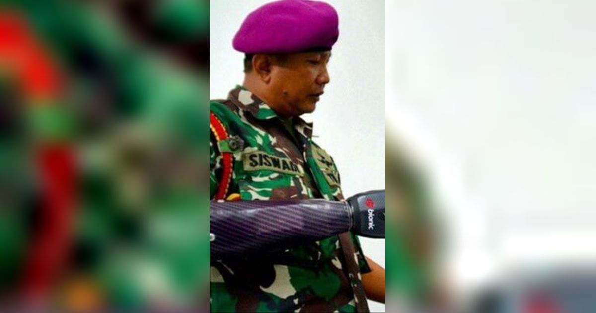 Prajurit TNI AL Ini Memiliki Lengan 'Robot' Biotik, Pernah Kehilangan Tangan Karena Granat