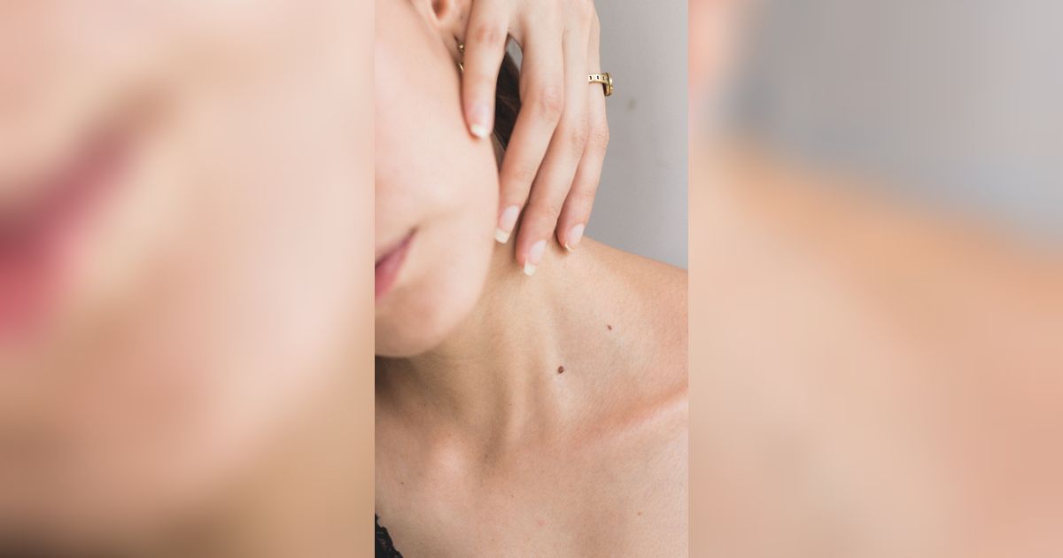 5 Jenis Dermatitis yang Umum Terjadi, Pahami Penyebabnya