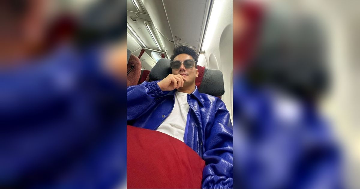 Blak-blakan Boy William Akui Operasi Hidung, Demi Ayu Ting Ting?