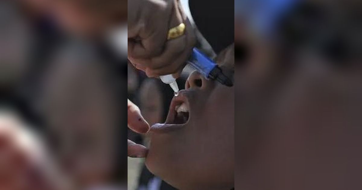 Kondisi Terkini Anak Kena Polio di Klaten