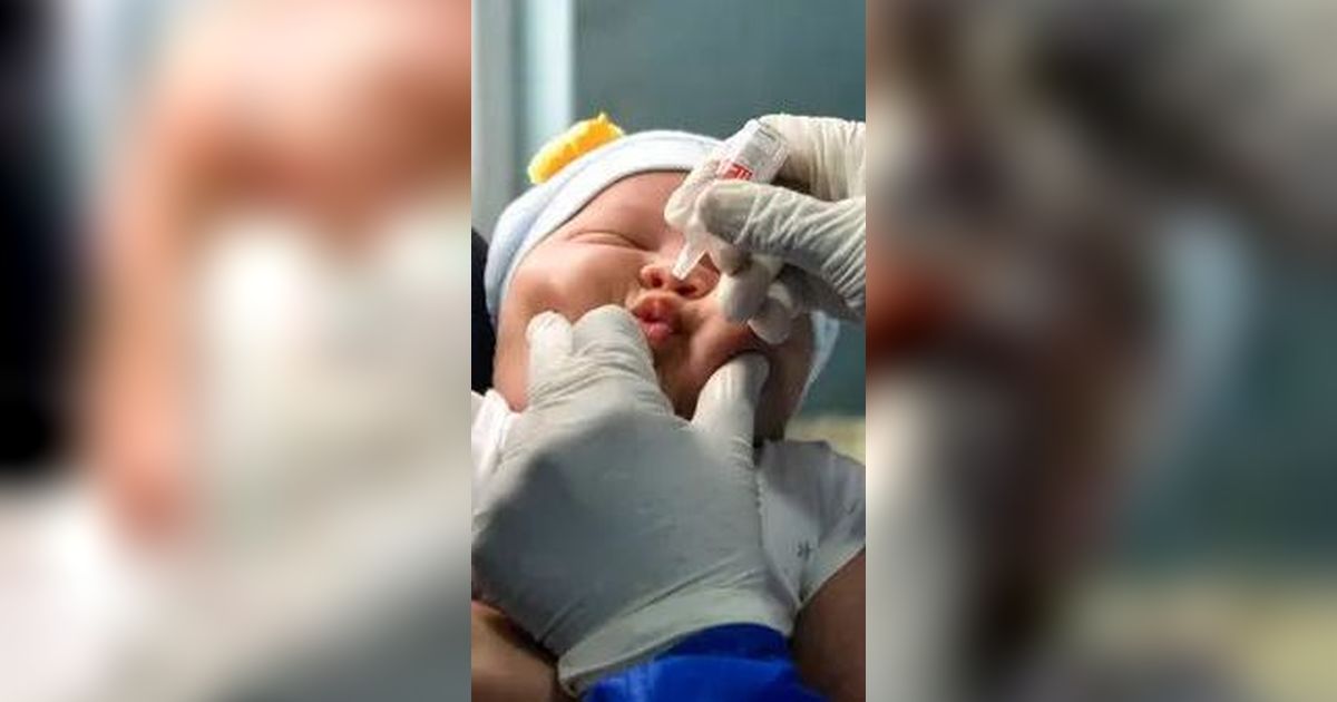 Dokter Ungkap Penyebab Anak Rentan Kena Polio