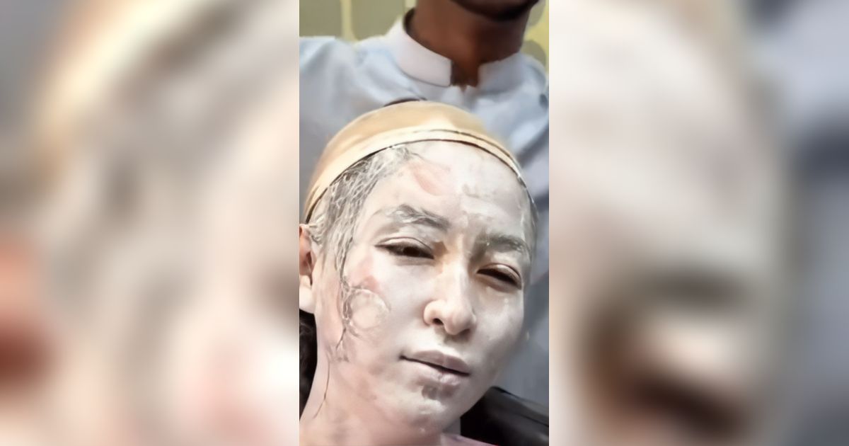 Ngakak! Turis Wanita Ingin Coba Treatment Wajah ala India, Bukannya Glowing Mukanya Malah Diobok-obok dan Bikin Trauma