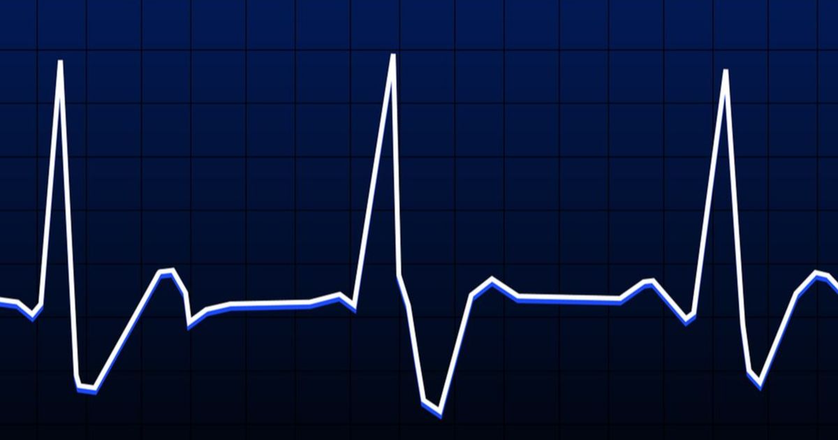 Apa Itu Resting Heart Rate? Kenali Standard yang Berbeda pada Setiap Orang