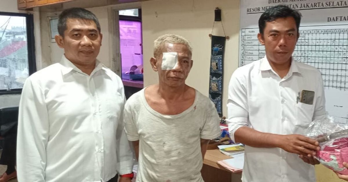 Berkaos Lusuh dan Mata Diperban, Begini Tampang Penyandera Bocah di Pospol Pejaten Village Jaksel