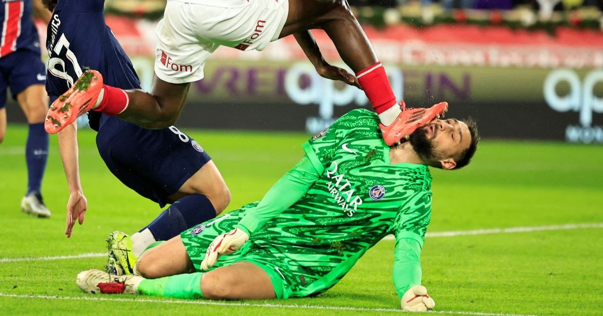 FOTO: Ngeri! Begini Kondisi Wajah Donnarumma Berdarah-darah Usai Tendangan Horor Wilfried Singo