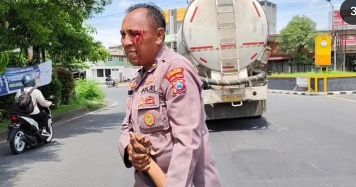 Kondisi Ipda Purnomo Polisi Baik Dipukul ODGJ Hingga Berdarah-darah, Didorong Terbaring Masuk IGD RS