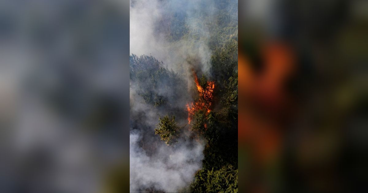 SEMENIT PAHAM: Jangan Percaya Mitos, Ini Tips Obati Luka Bakar