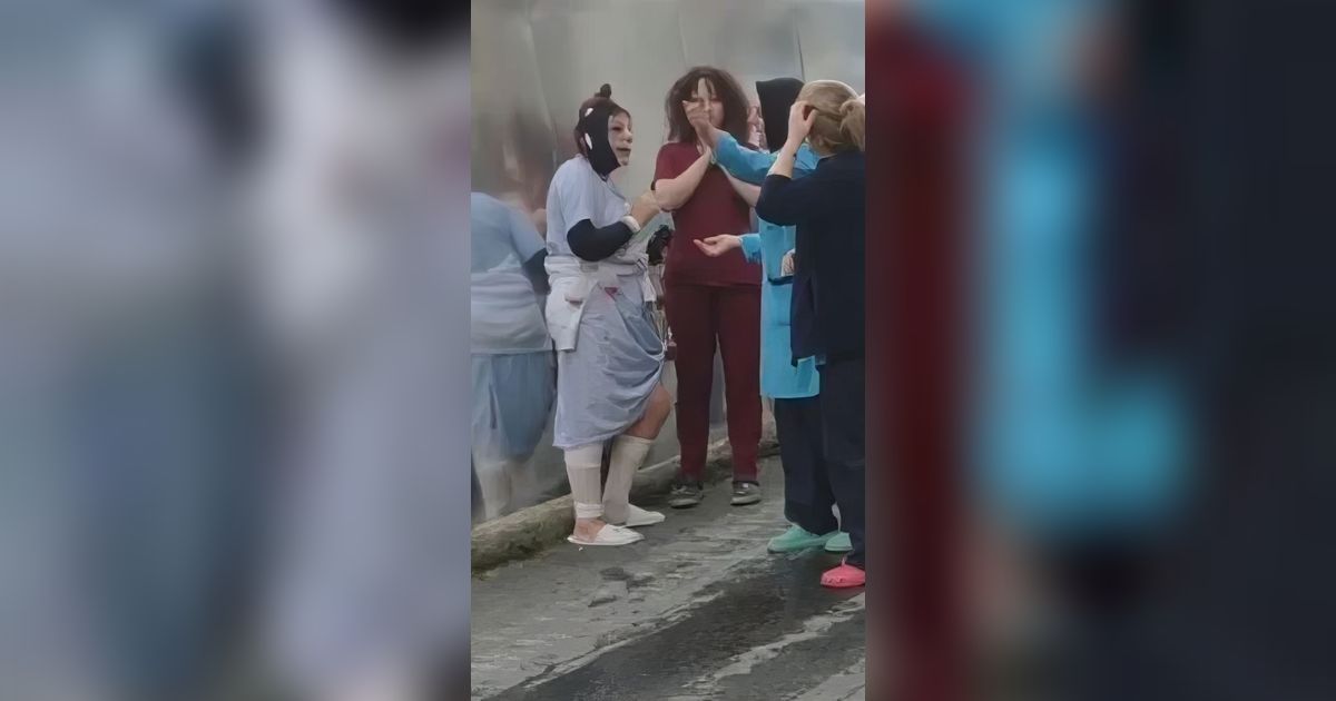 Heboh Wanita Kabur dari Rumah Sakit Usai Jalani Operasi Plastik, Alasannya Bikin Dokter dan Perawat Syok