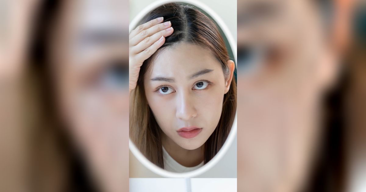 Rambut Mudah Berminyak? Tenang, Ada 5 Cara Mengatasinya