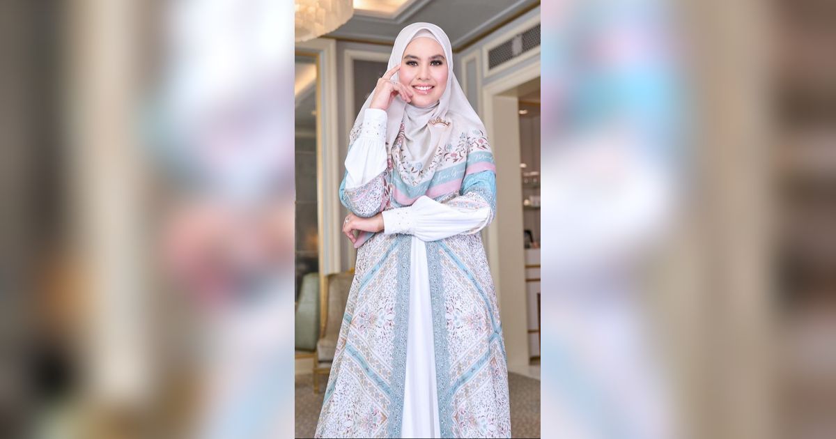 Kulit Wajahnya Sempat Melepuh, Begini Kondisi Terbaru Kartika Putri