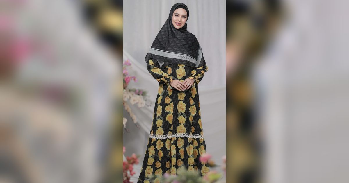5 Potret Kartika Putri Sebelum Terkena Penyakit Autoimun Wajah Penuh Luka