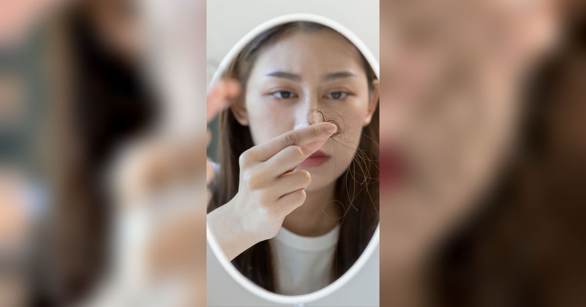 4 Kondisi Kesehatan yang Bikin Rambut Rontok, Cari Tahu Biar Tak Salah Kaprah