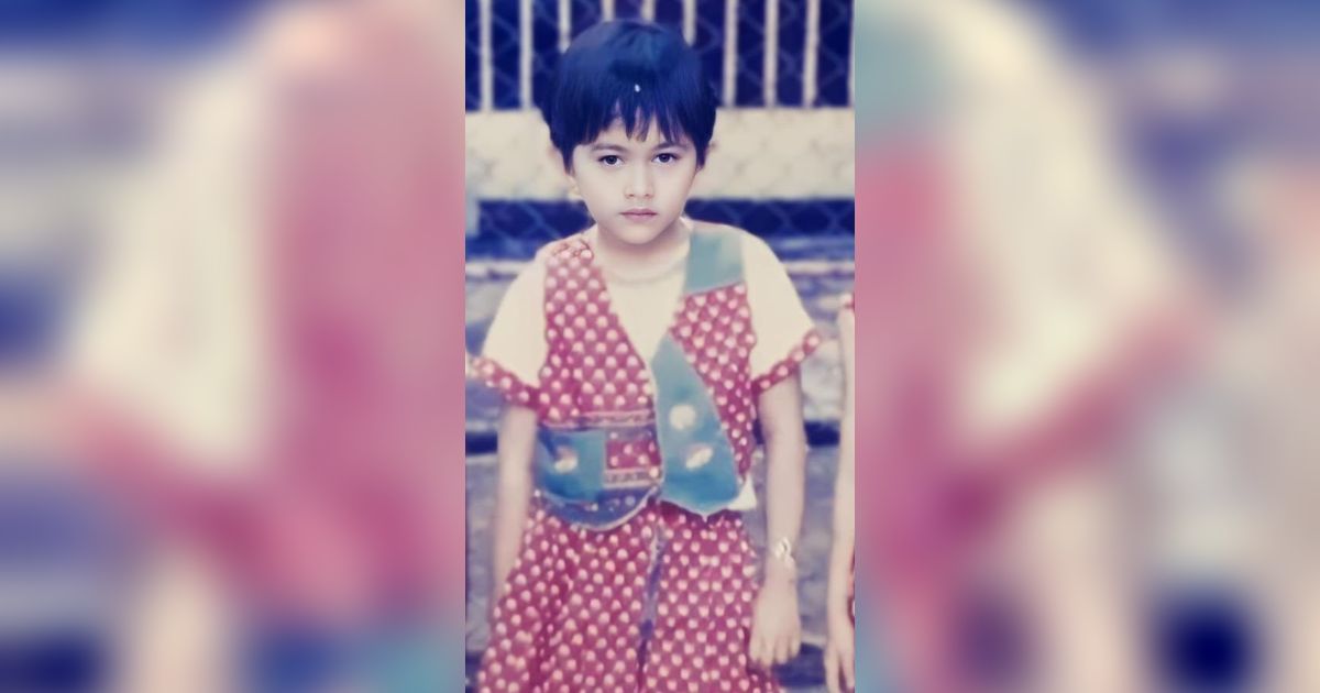 Bocah Cantik Berambut Pendek Ini Gedenya jadi Artis Terkenal, Terbaru Bikin Geger Publik dengan Wajahnya Penuh Luka