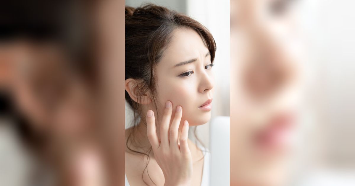 Tak Bisa Dihindari, Kenali Tahapan Ketika Kulit Mulai Alami Penuaan