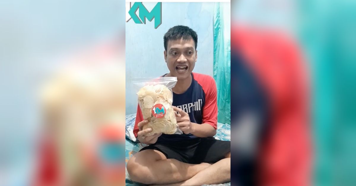 Kini Jualan Keripik Emping, Begini Kabar Terbaru Kurnia Meiga yang Idap Penyakit Papiledema