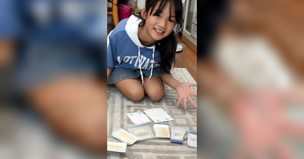 Keren, Inovasi Plester Luka Bikinan Bocah 10 Tahun Jadi Produk Perusahaan Obat Besar