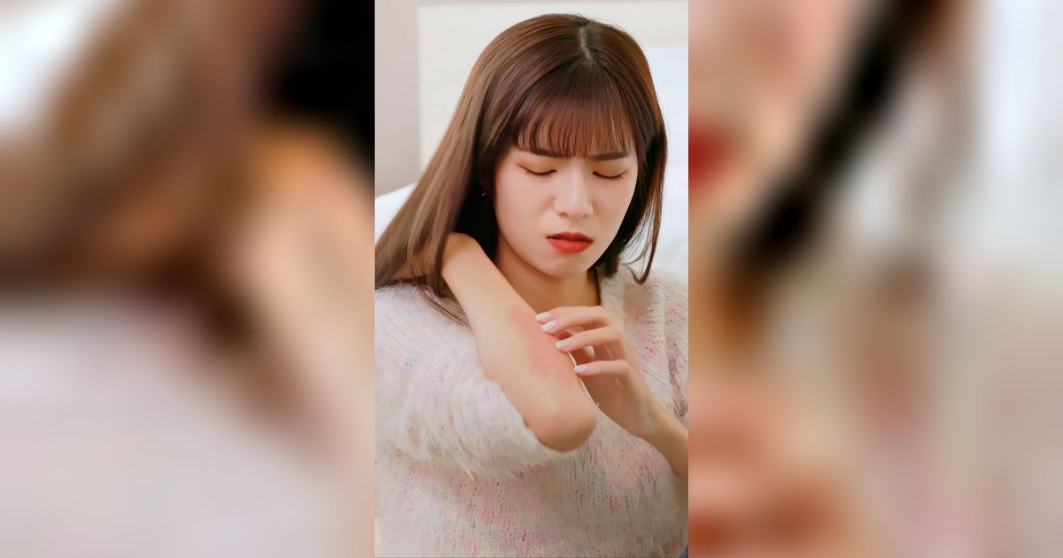 Kulit Sering Terasa Kering dan Gatal, Bisa jadi Tanda Diabetes