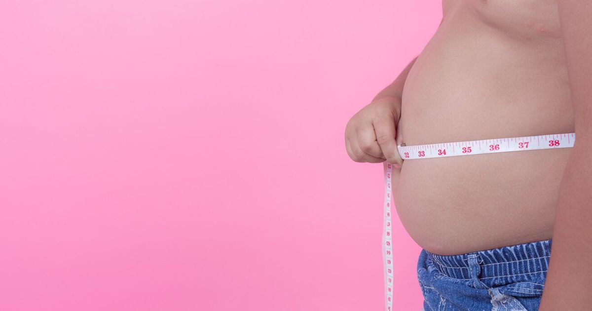 Apakah Obesitas Anak Bisa Disebabkan Faktor Genetik? Begini Penjelasan Dokter