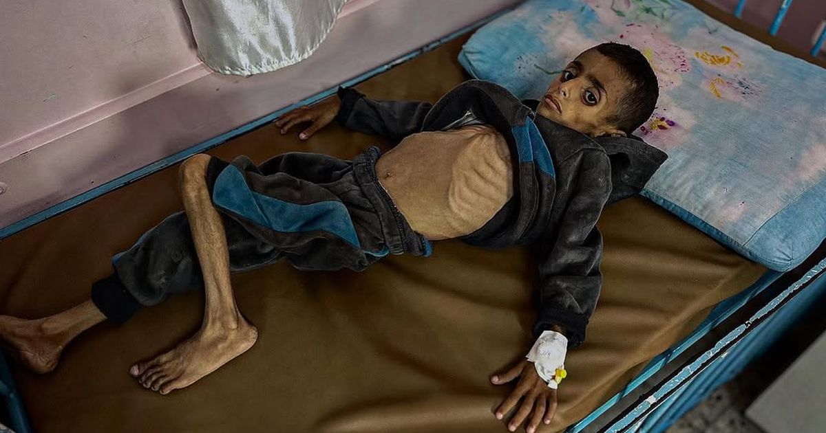 'Sejauh Mata Memandang, Anda Melihat Orang-Orang Kurus Kering Kelaparan'