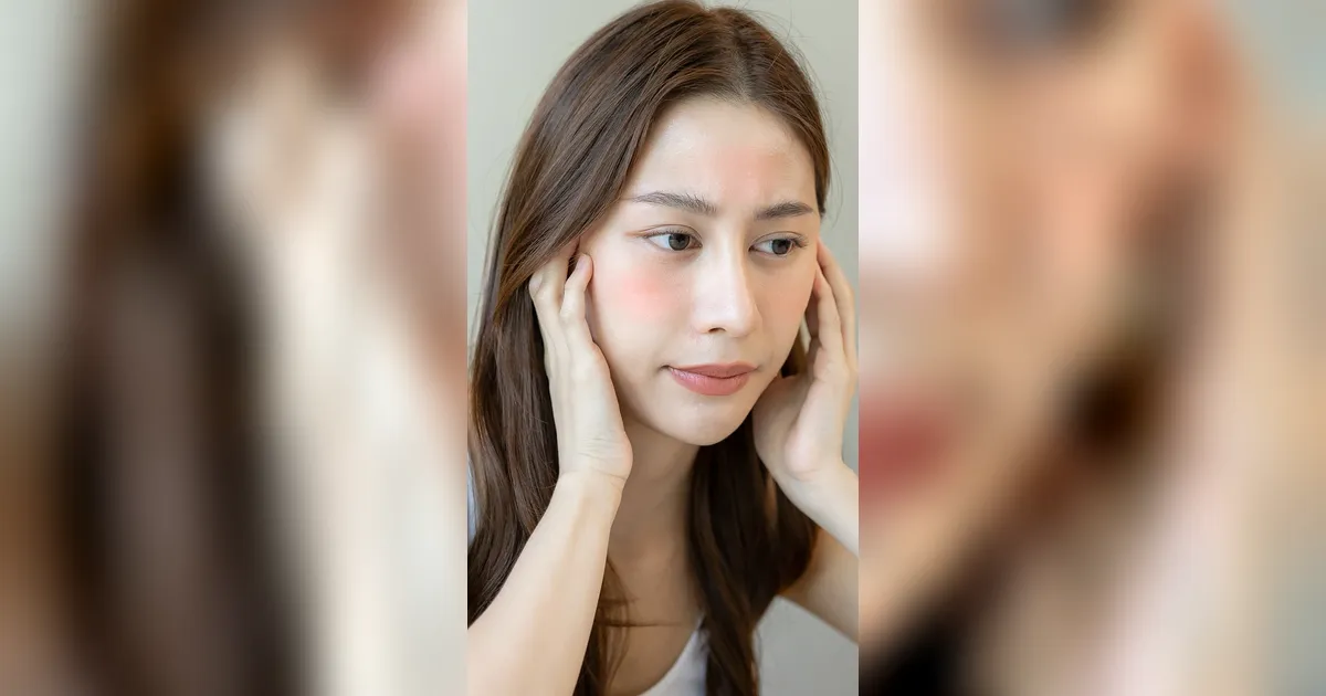 Noda Bekas Jerawat Tak Kunjung Pudar? Ini Hal yang Sering Terlewat