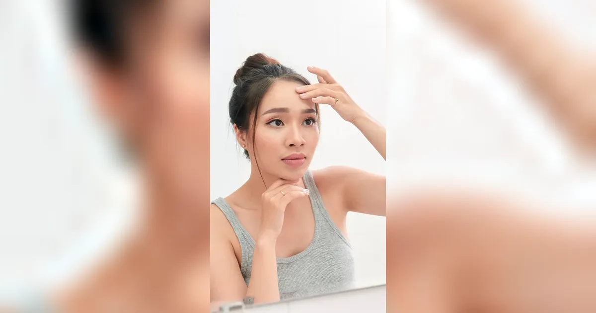 Mirip tapi Tak Sama, Kenali Perbedaan PIE vs PIH Agar Bekas Jerawat Cepat Memudar