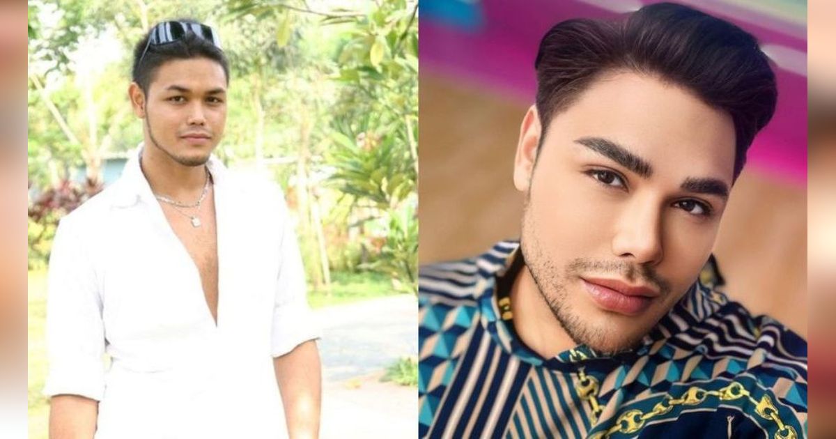 15 Transformasi Artis yang Lakukan Veneer Gigi, Hasilnya Semakin Putih dan Bersinar