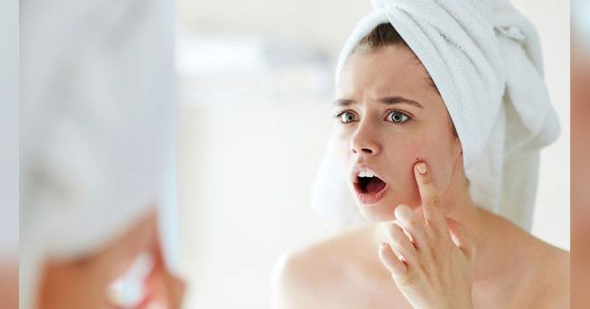 20 Rekomendasi Skincare untuk Menghilangkan Milia Terbaik Edisi 2024