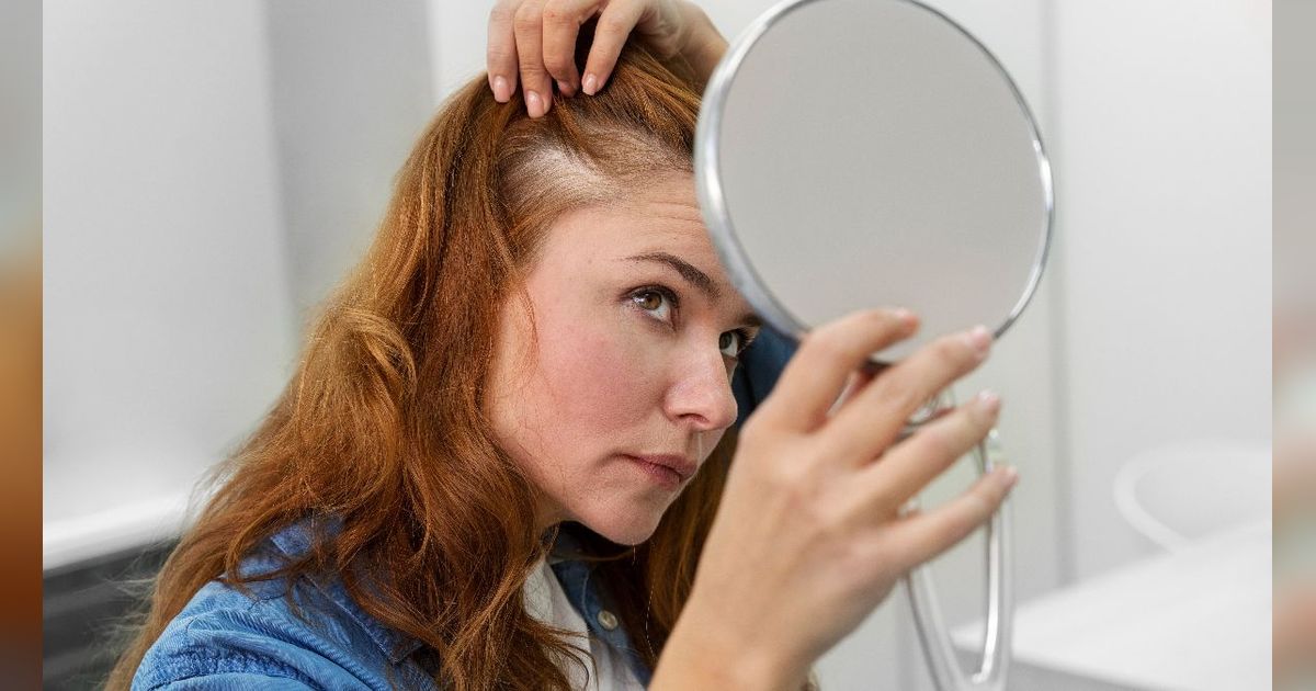 5 Kesalahan Sepele yang Bikin Rambut Rontok, Salah Satunya Cara Keramas yang Salah