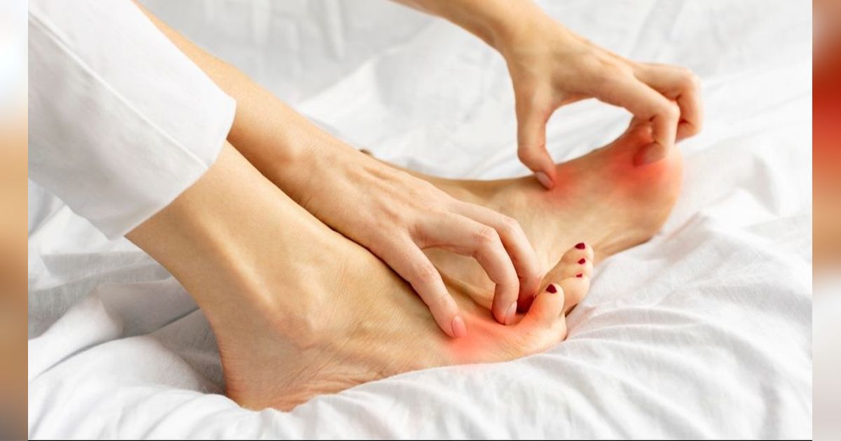 Kaki Terus Menerus Gatal Saat Hamil, Normalkah?