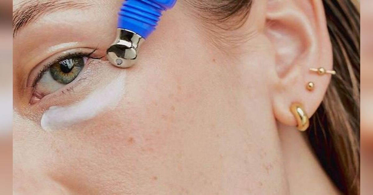 Apa itu Milia? Dapatkah Hilang Hanya dengan Skincare? Ini Jawabannya