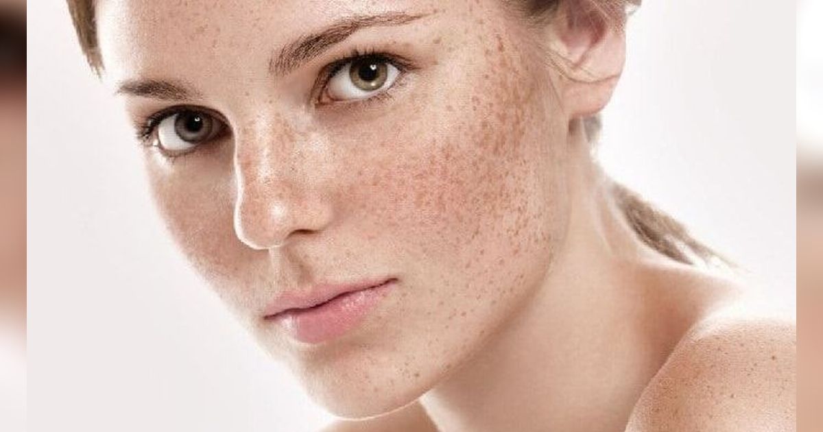 Bisakah Flek Hitam Dihilangkan Hanya dengan Skincare? Begini Cara Memilih Produk yang Tepat