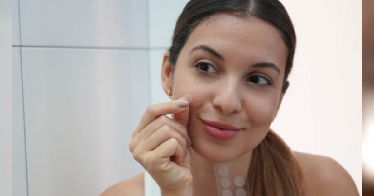 Acne Patch Efektif Gak Sih Hempas Jerawat? Mari Cari Tahu
