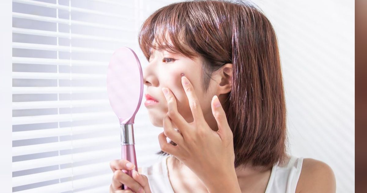 5 Rutinitas Penting Atasi Jerawat Hormonal yang Mengganggu, Bisa Bantu Wujudkan Kulit Glowing Impianmu