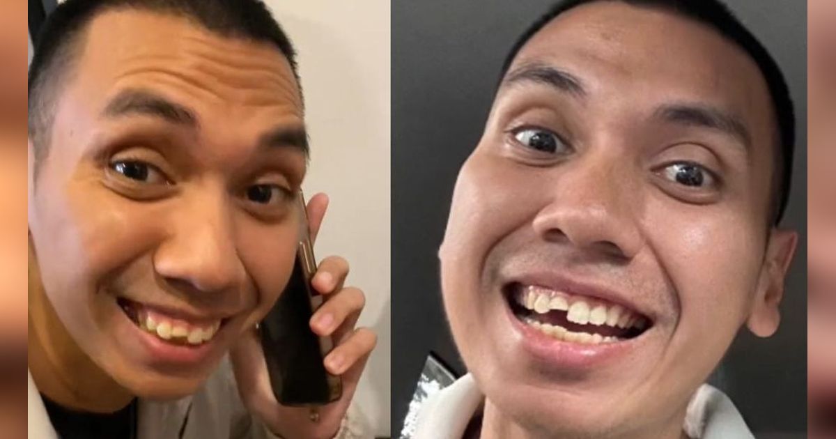 Rayi RAN Curhat Giginya Patah Saat Makan, Netizen: Masih Ketolong Sama Wajah Tampan