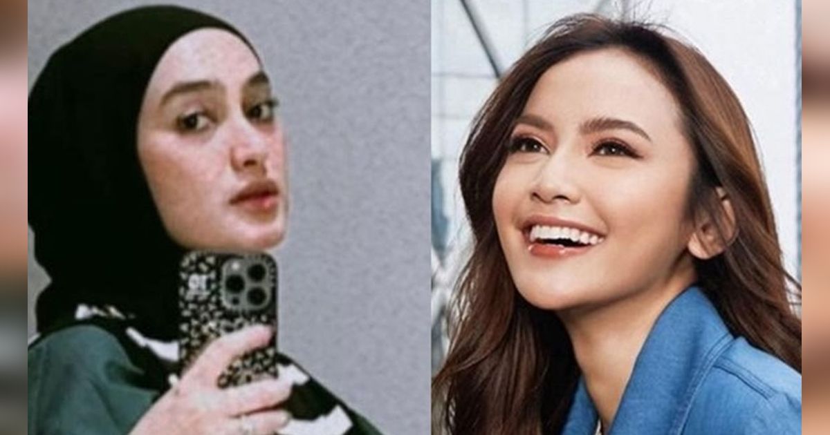 10 Adu Cantik Mahalini Raharja VS Syantika Fauziah, Pacar Baru Sule yang Seumuran Rizky Febian