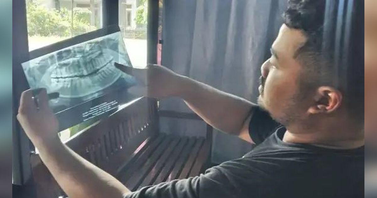 Berawal Cabut Gigi Bungsu, Perempuan di Ngawi Meninggal Dunia Akibat Infeksi dan Nanah di Paru